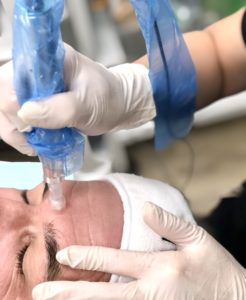 Skin Care Calgary
