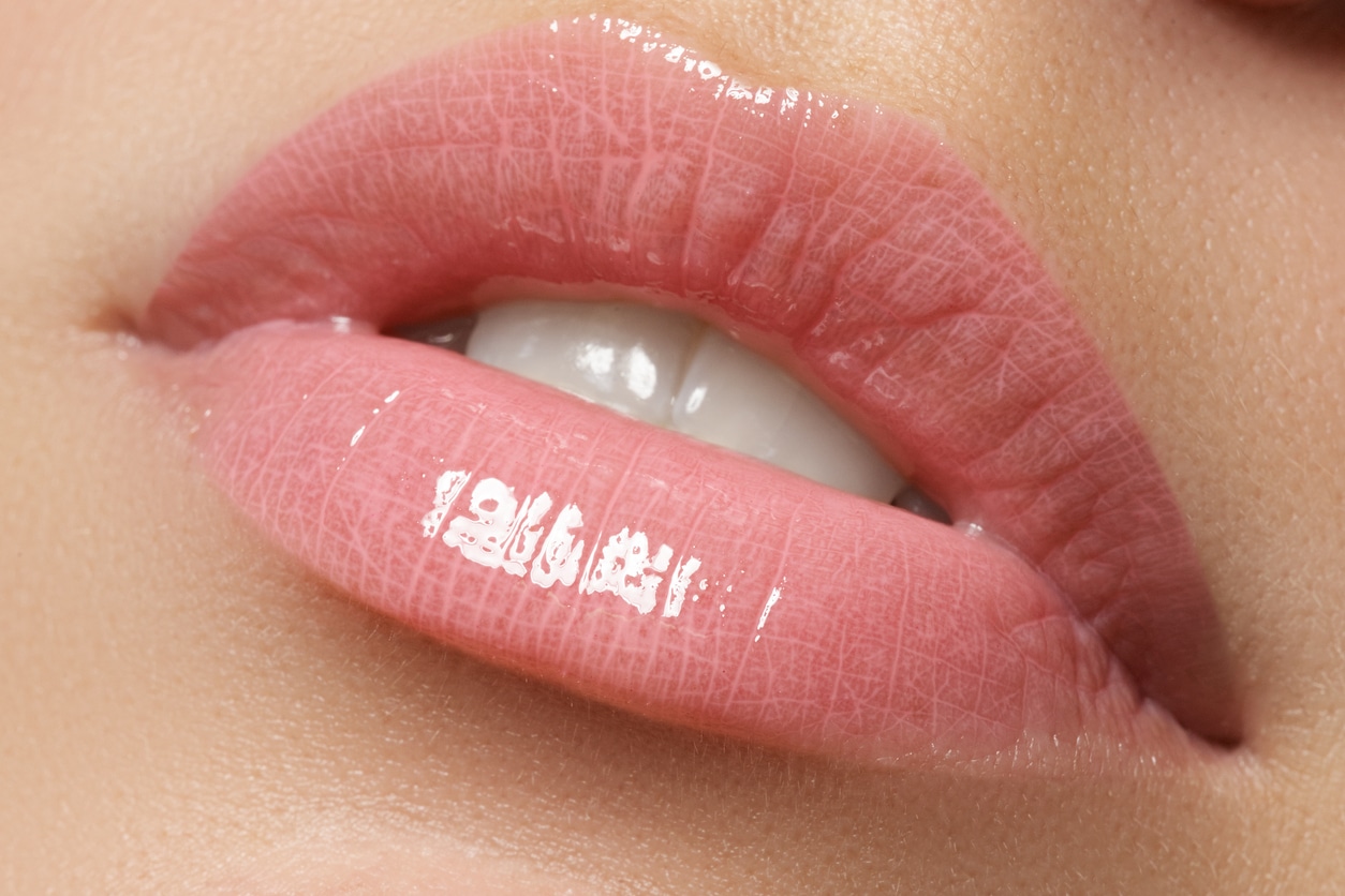 A close up of a woman's lips after receiving lip filler in Calgary.