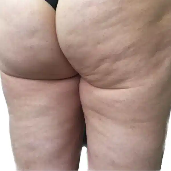 image-venus-legacy-before-after-1_before