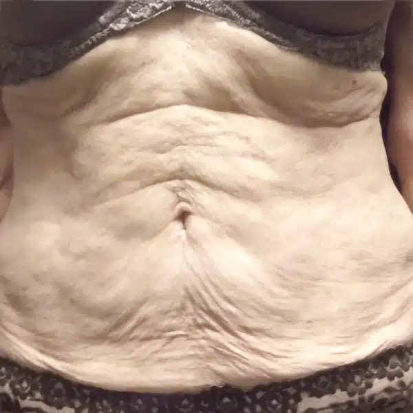 image-venus-legacy-before-after-4_before