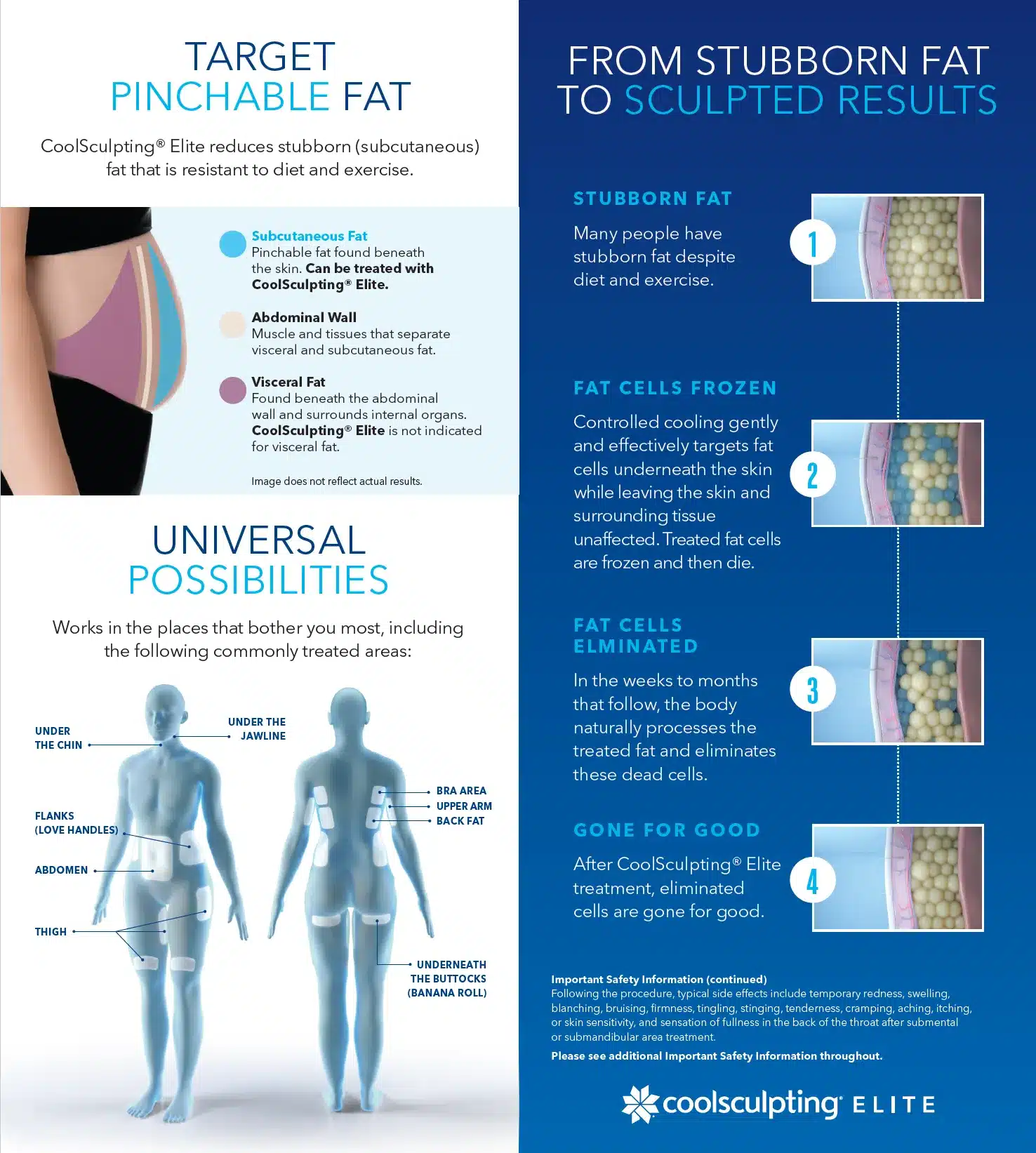 vive-med-spa_coolsculpting_how-and-where-it-works