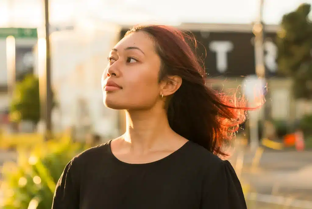 EXION Fractional RF Microneedling