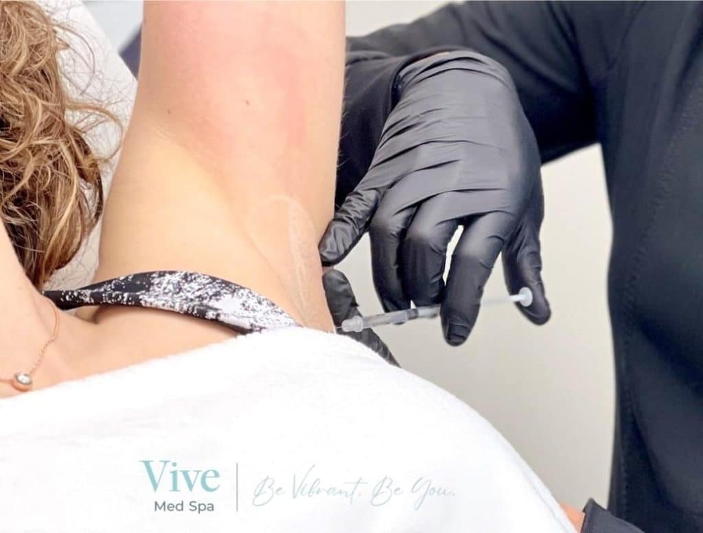 Botox treatment for excessive underarm sweating