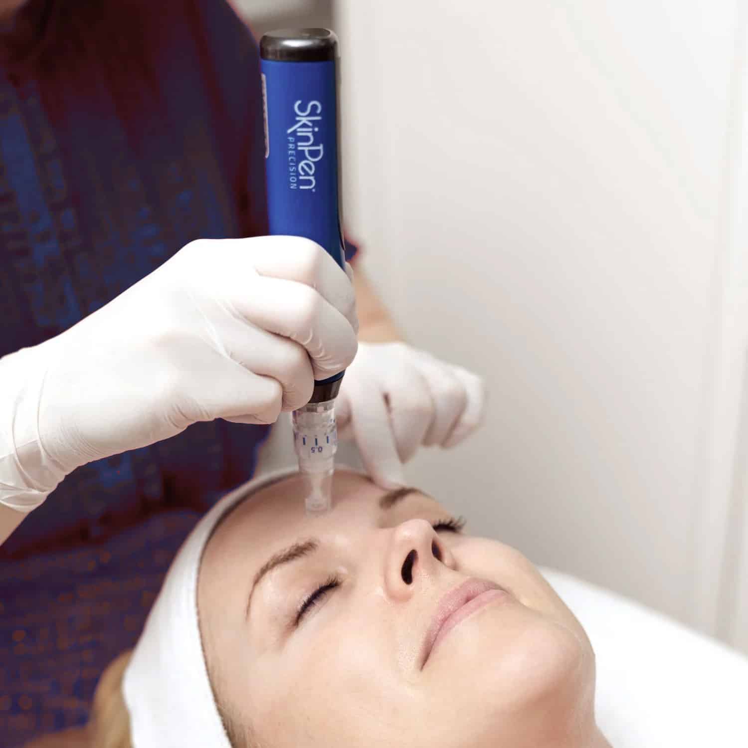 Microneedling Calgary The Cost of Skinpen Microneedling