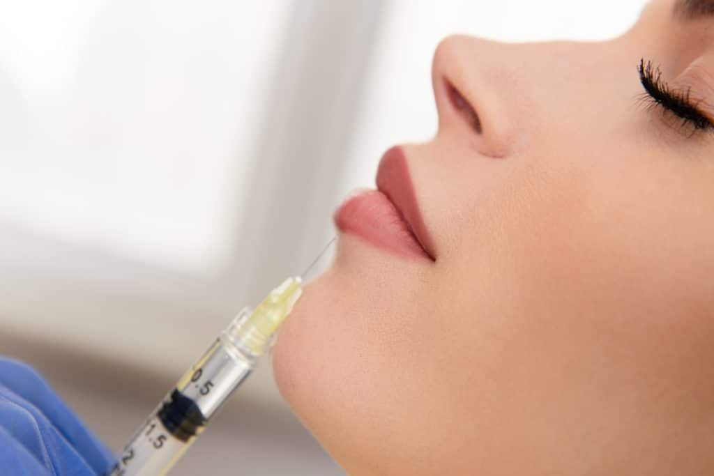 Close up of a woman getting lip injections at a medi spa in Calgary.