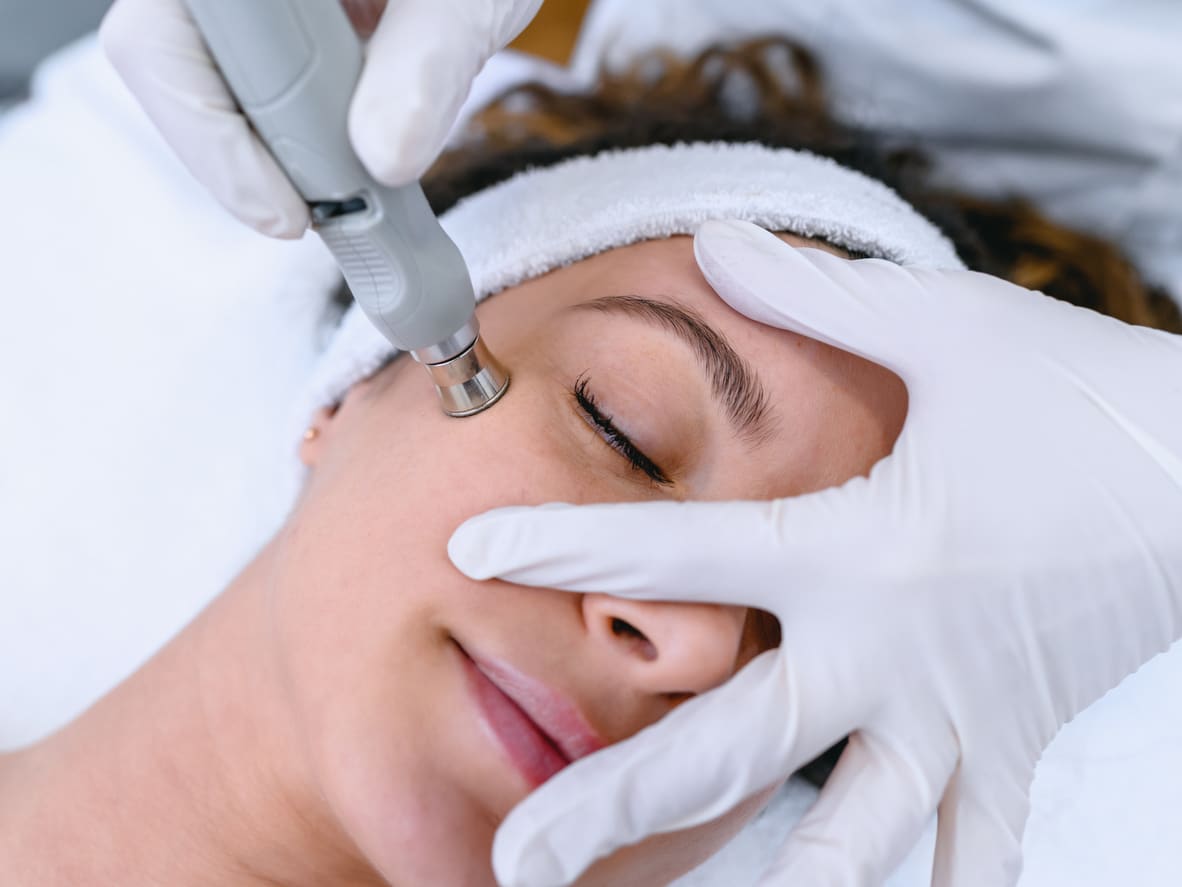 Laser & Light Treatment Guide Medi Spa in Calgary Vive Med Spa