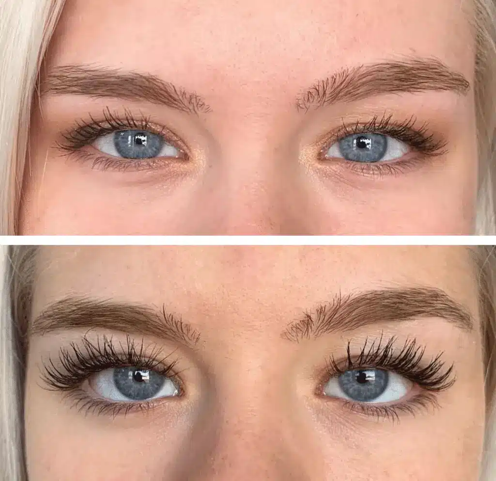Thinning Eyelash Treatment in Calgary Vive Med Spa
