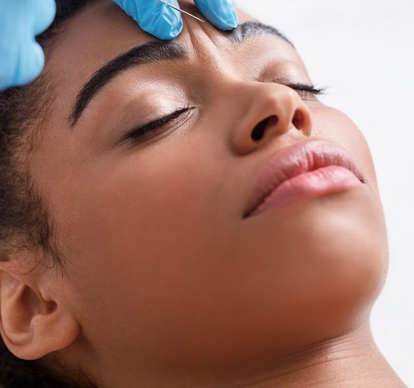 Botox Calgary